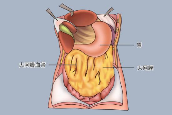 大网膜位置图