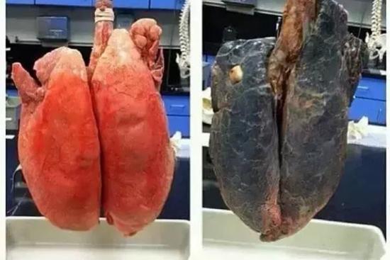 不吸烟者与吸烟者肺对比图