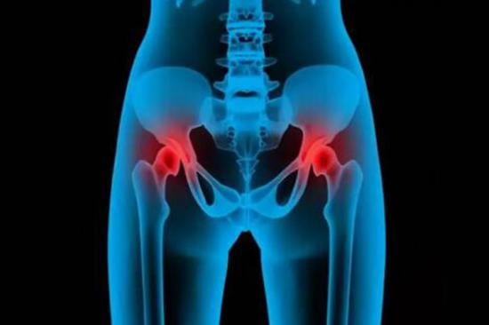 股骨头位置图
