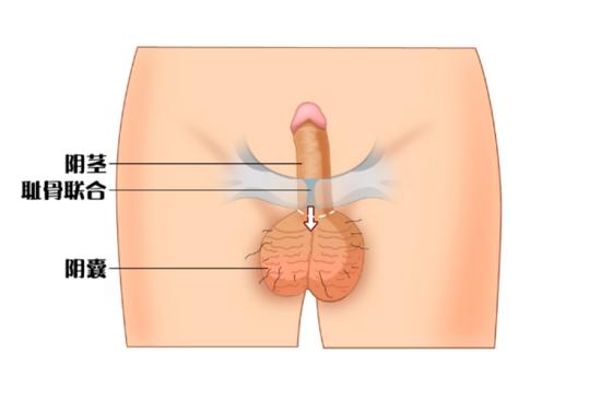 阴囊位置图