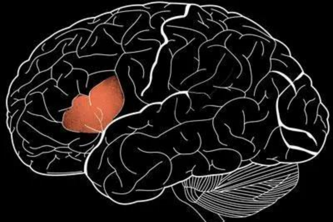 布罗卡氏区位置图