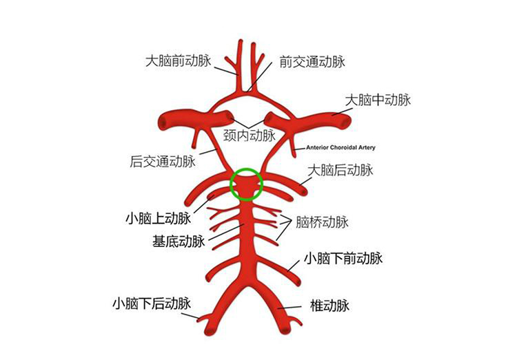 基底动脉解剖图