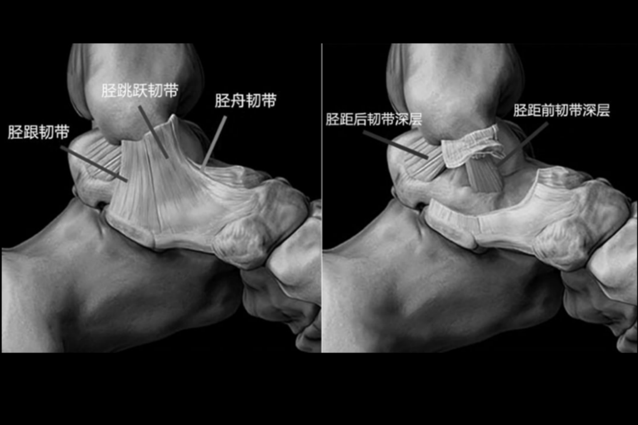 三角韧带位置示意图