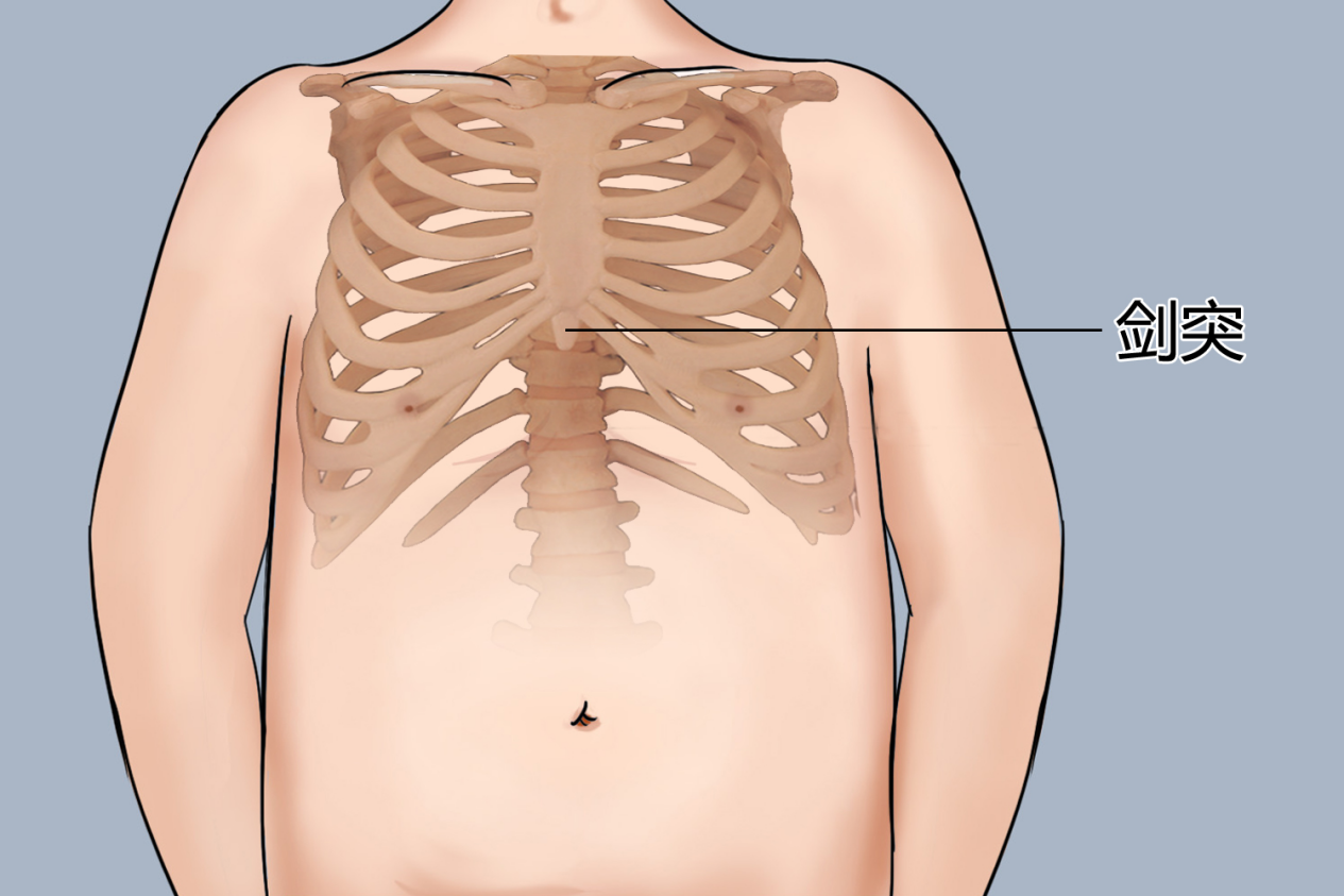 剑突位置图 剑突位置图