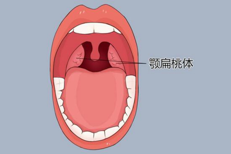 腭舌弓和腭咽弓位置图图片