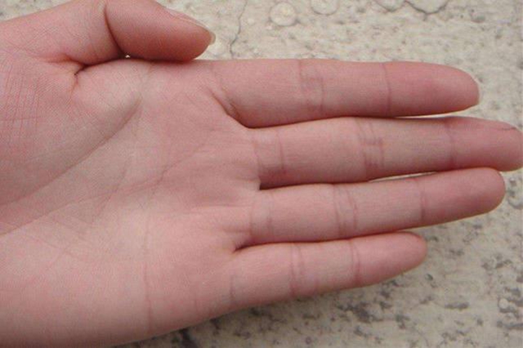 正常的手掌颜色图