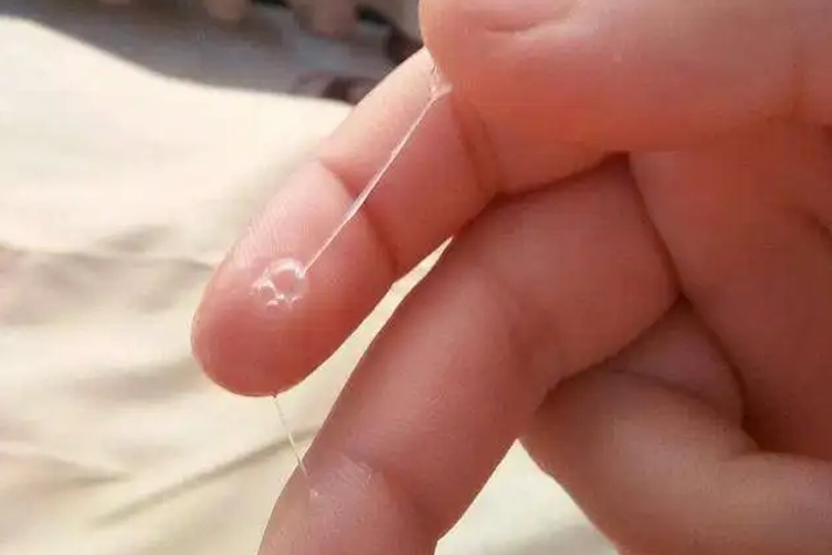 泡沫状白带图 泡沫状白带图