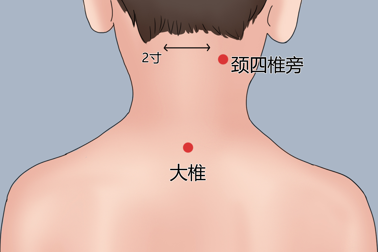 小儿大椎穴图