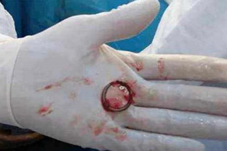 O型环取出后图 O型环取出后图