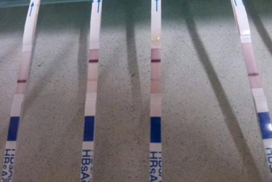 乙肝表面抗原胶体金检测试纸两道杠图