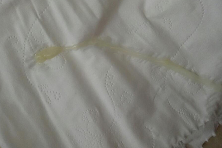 怎么会有白色分泌物 1654744620564151.png