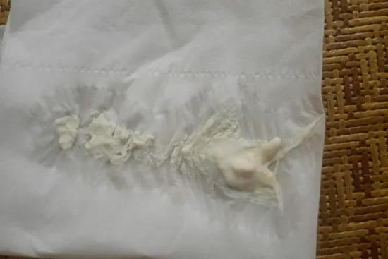 白色药渣样分泌物