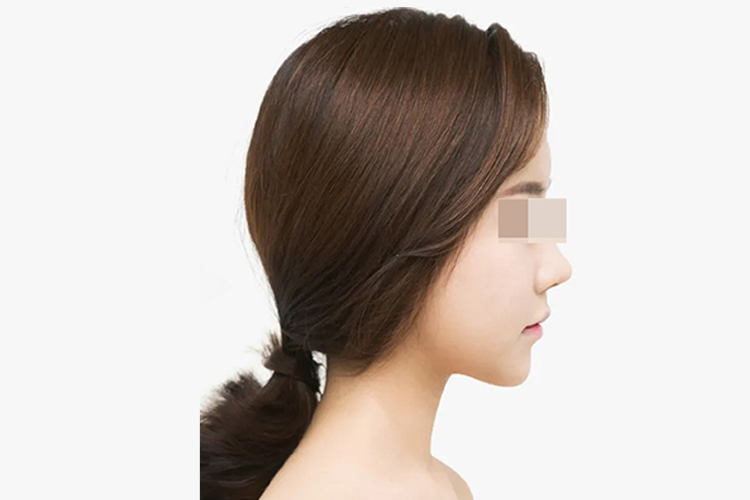 小翘鼻图(右侧)