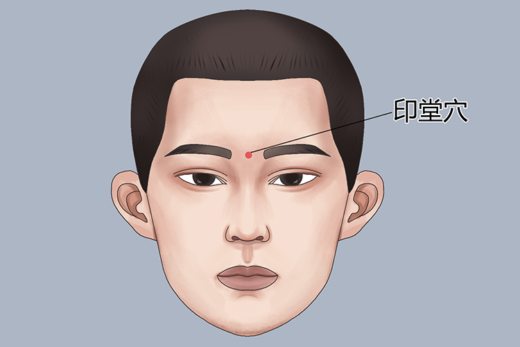 印堂穴位置图 印堂穴位置图