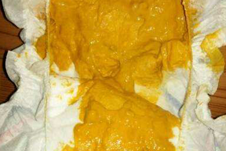 母乳宝宝大便正常图