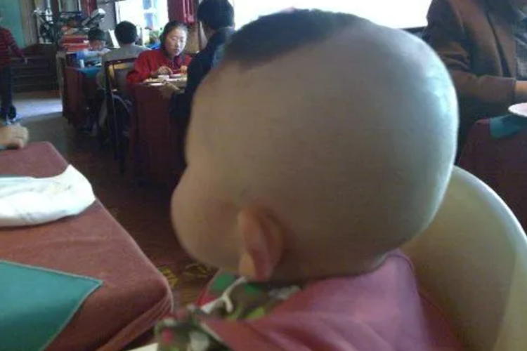 婴儿正常后脑勺图