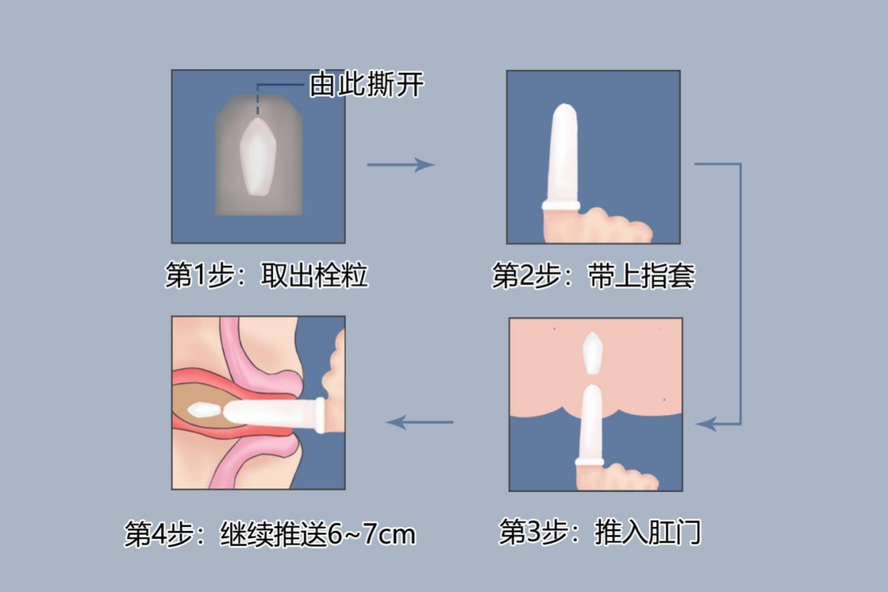 塞药位置示意图图片