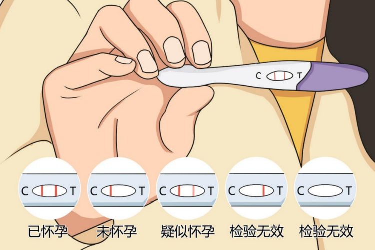 验孕棒CT结果图