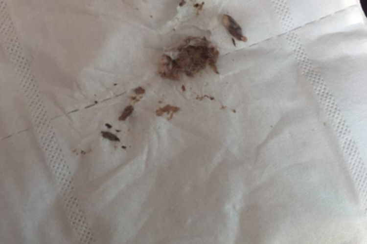 雪诺同正常褐色药渣图