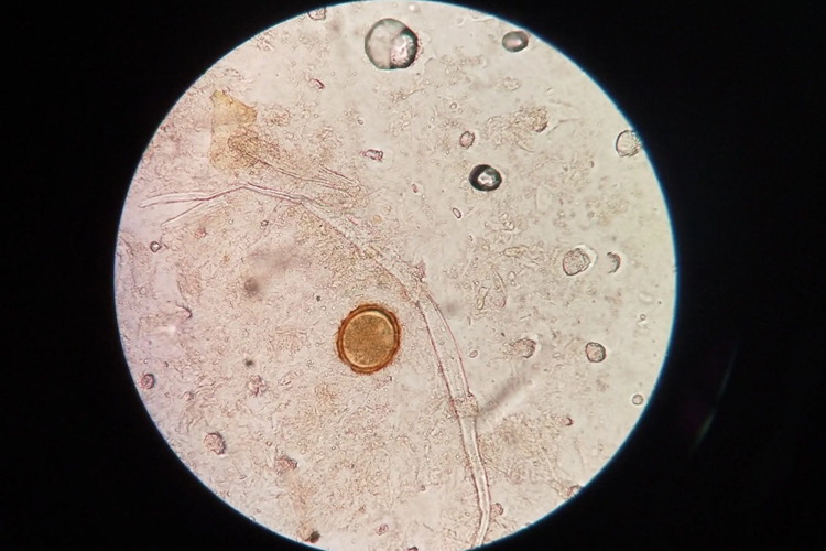 电镜下受精蛔虫卵图