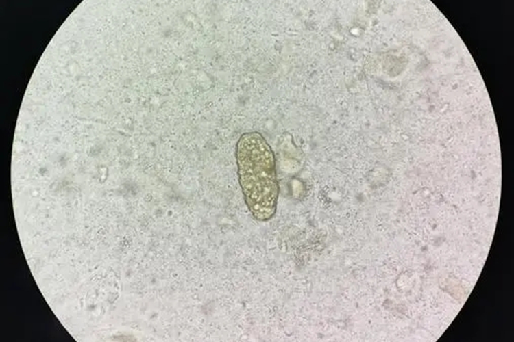 电镜下未受精蛔虫卵图