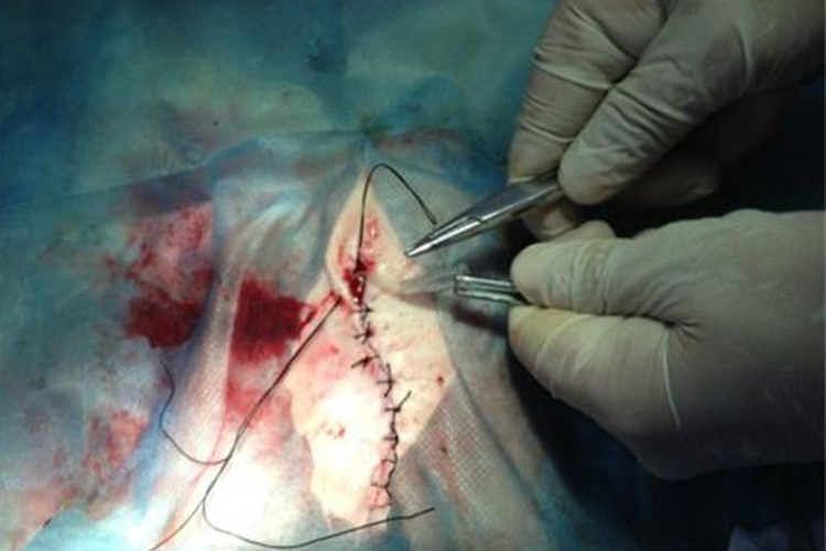 缝合伤口图 缝合伤口图