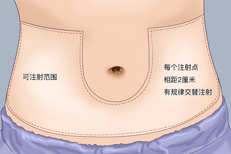 注射位置图