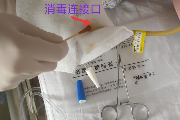 引流管止流并消毒步骤图