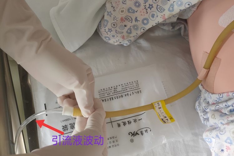 松开止血钳步骤图