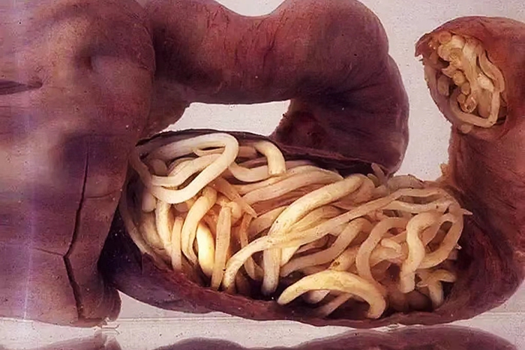 肠道蛔虫图