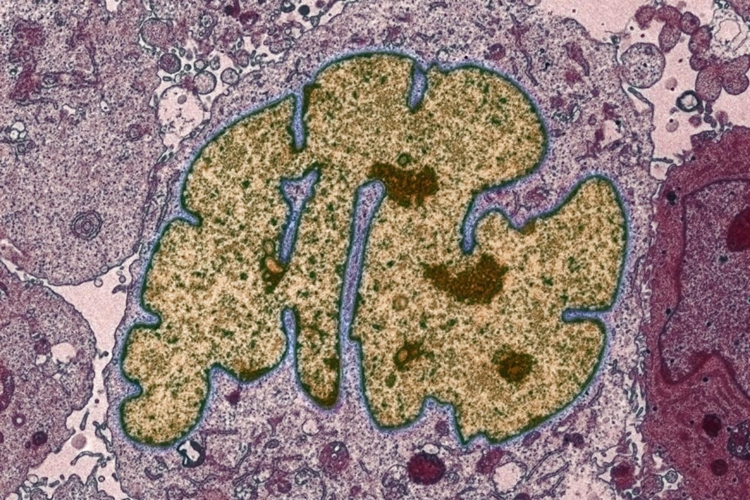 癌细胞电镜下形态图