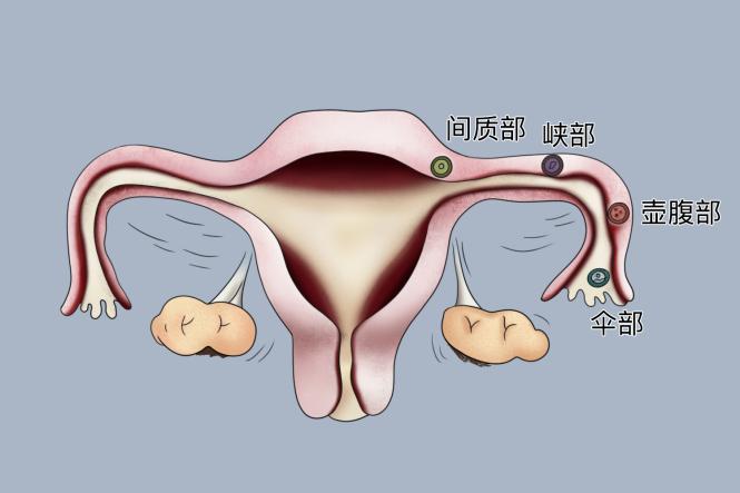 输卵管壶腹部图