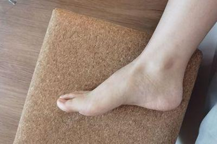 轻度脚背高图 轻度脚背高图